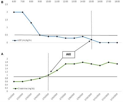 Big Data and Pediatric Acute Kidney Injury: The Promise of Electronic Health Record Systems